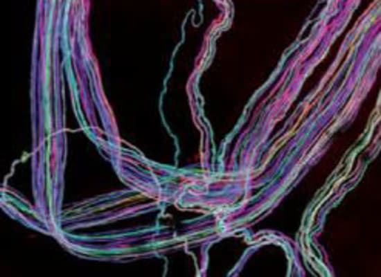 נוירונים של עכבר צבועים בטכנולוגיית Brainbow שפיתח סיינס / הדמיה: מתוך מחקר של סיינס נוירונים של עכבר צבועים בטכנולוגיית Brainbow שפיתח סיינס / הדמיה: מתוך מחקר של סיינס
