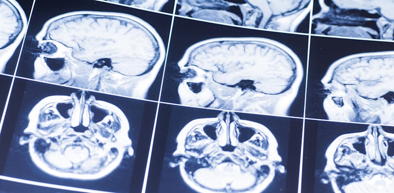 צילום: Shutterstock