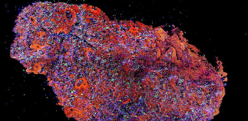 צילום: באדיבות בטאלין