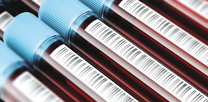 "אילוסטרציה של דגימות דם / צילום: Shutterstock"