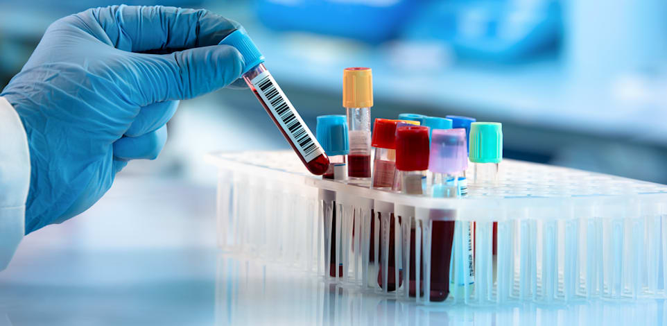 בדיקות מעבדה / אילוסטרציה: Shutterstock