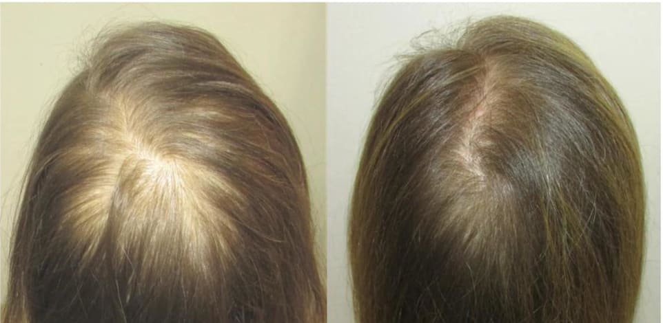 לפני ואחרי טיפולים במערכת MCT / צילום: ד''ר אלון שניידר