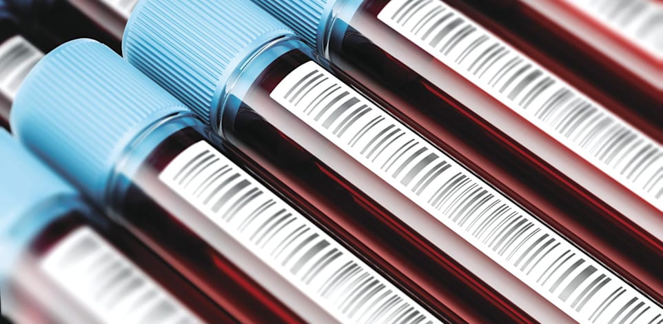 אילוסטרציה של דגימות דם / צילום: Shutterstock