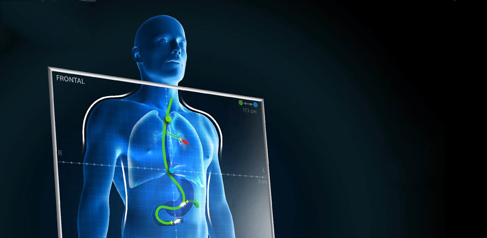 Envizion Medical credit: company presentation