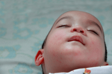 Paediatric Febrile Neutropenia