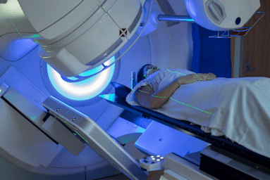 Radiotherapy for Non-Small Cell Lung Cancer