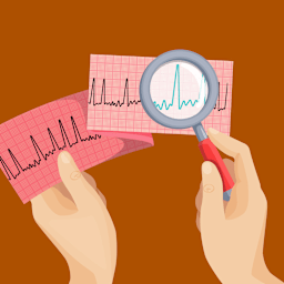 Tachyarrhythmias - Emergency nursing management