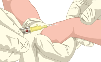 Venepuncture and IV Cannulation (3/5) - Special considerations for children and neonates