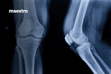 Knee Anatomy for Healthcare Professionals