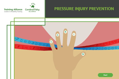 Pressure Injury Prevention