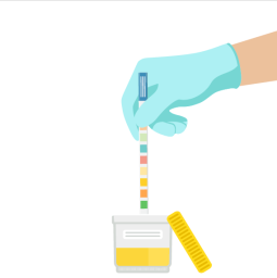 Urinalysis: A diagnostic test