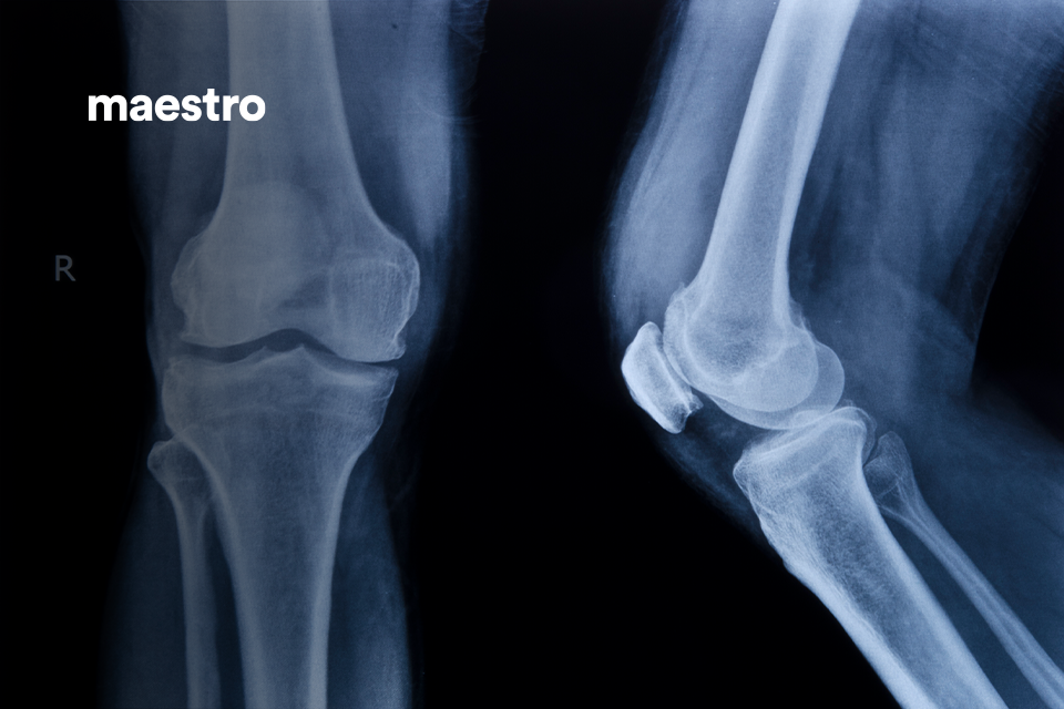 Knee Anatomy for Healthcare Professionals