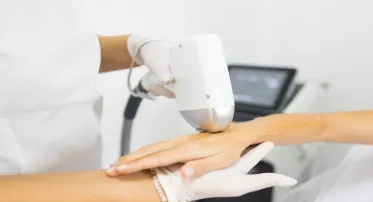 ٣ جلسات ليزر لمنطقة واحدة مع الرتوش – نعومة دائمة