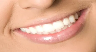 توريد لثة