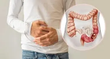Early Cancer Screening Package for Men