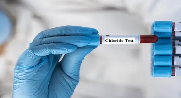 Chloride test