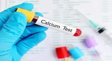Calcium in Serum (Total) test