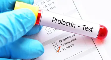 تحليل هرمون الحليب