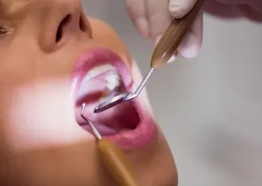 Aesthetic dental filling