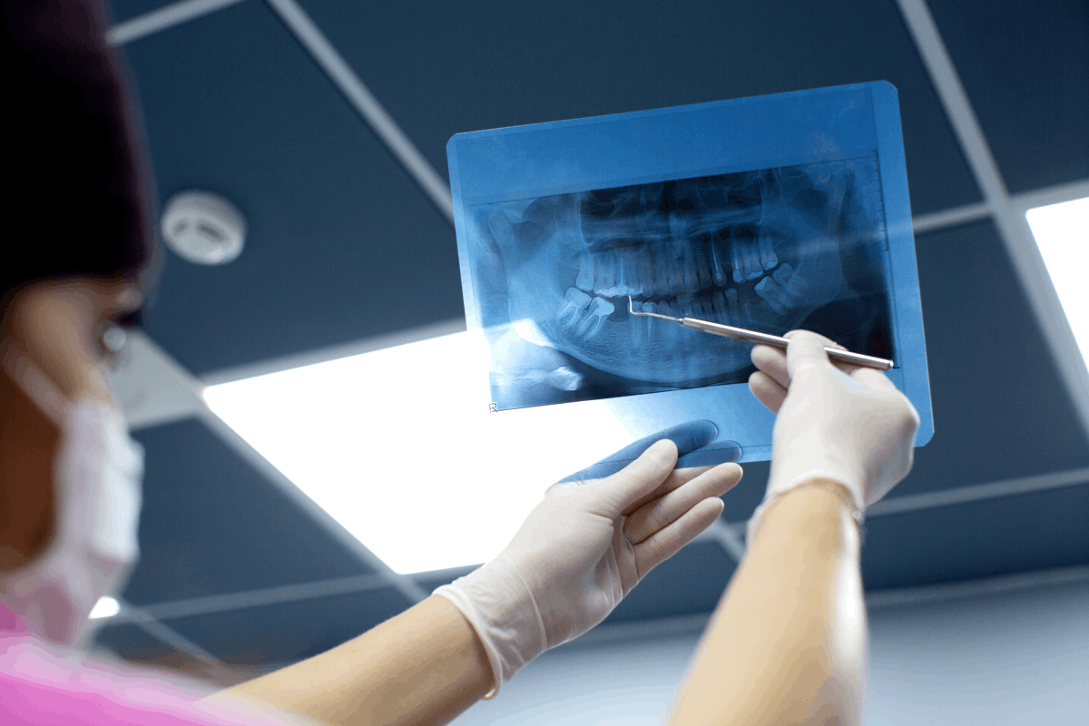 Cosmetic fillings, complete dental examination and periapical x-rays