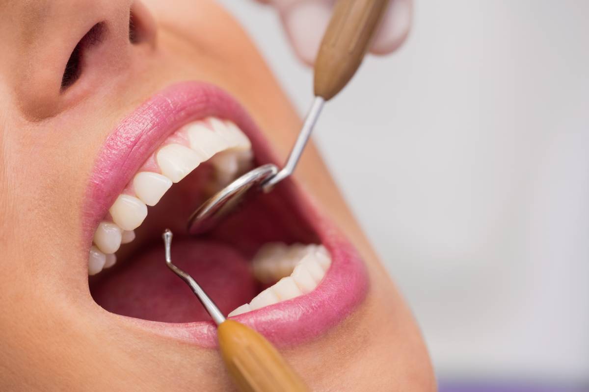 Root canal treatment starts from