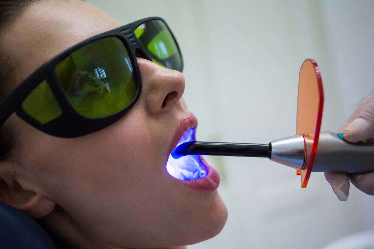 Laser teeth whitening