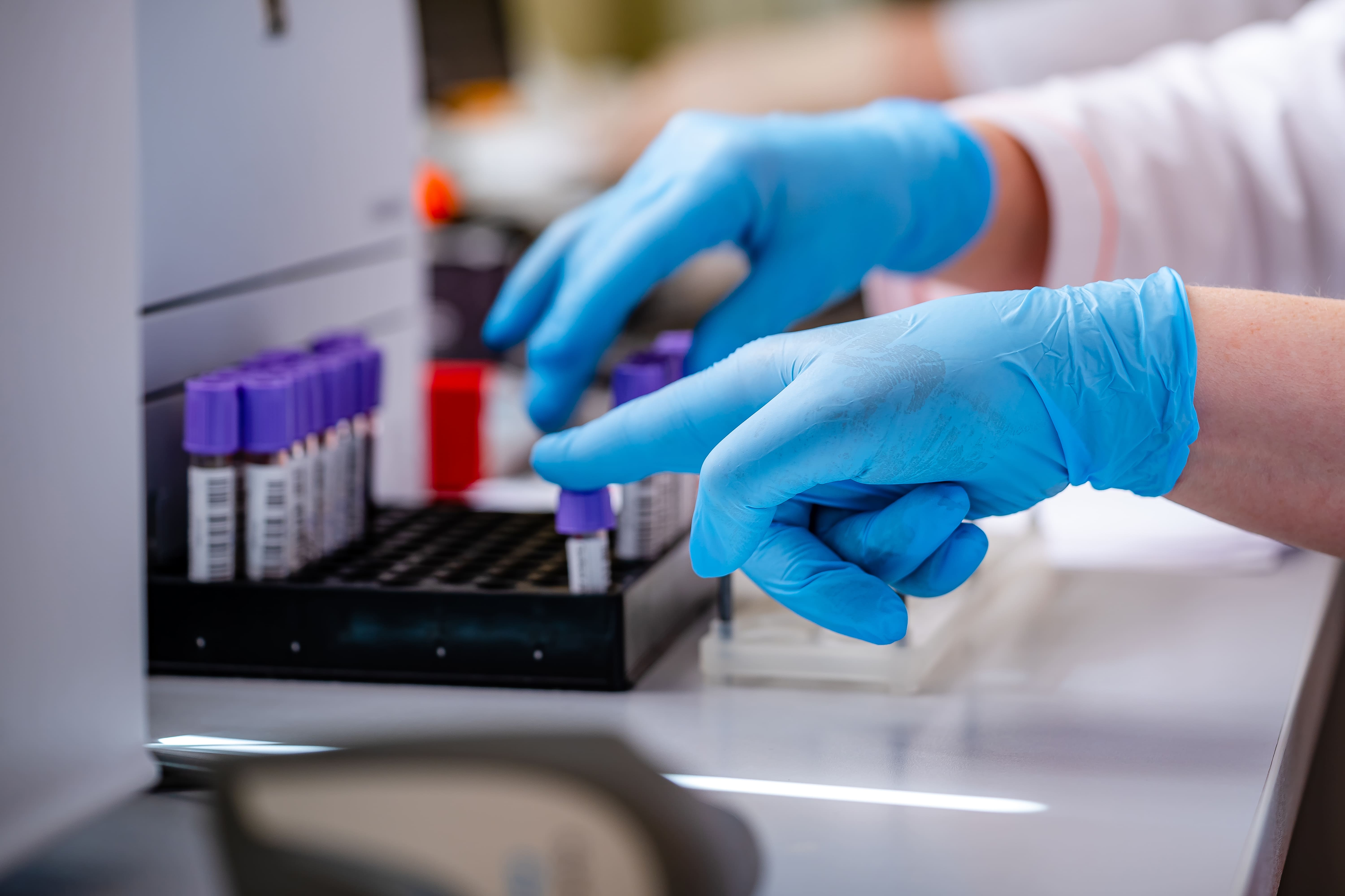 Luteinizing hormone analysis