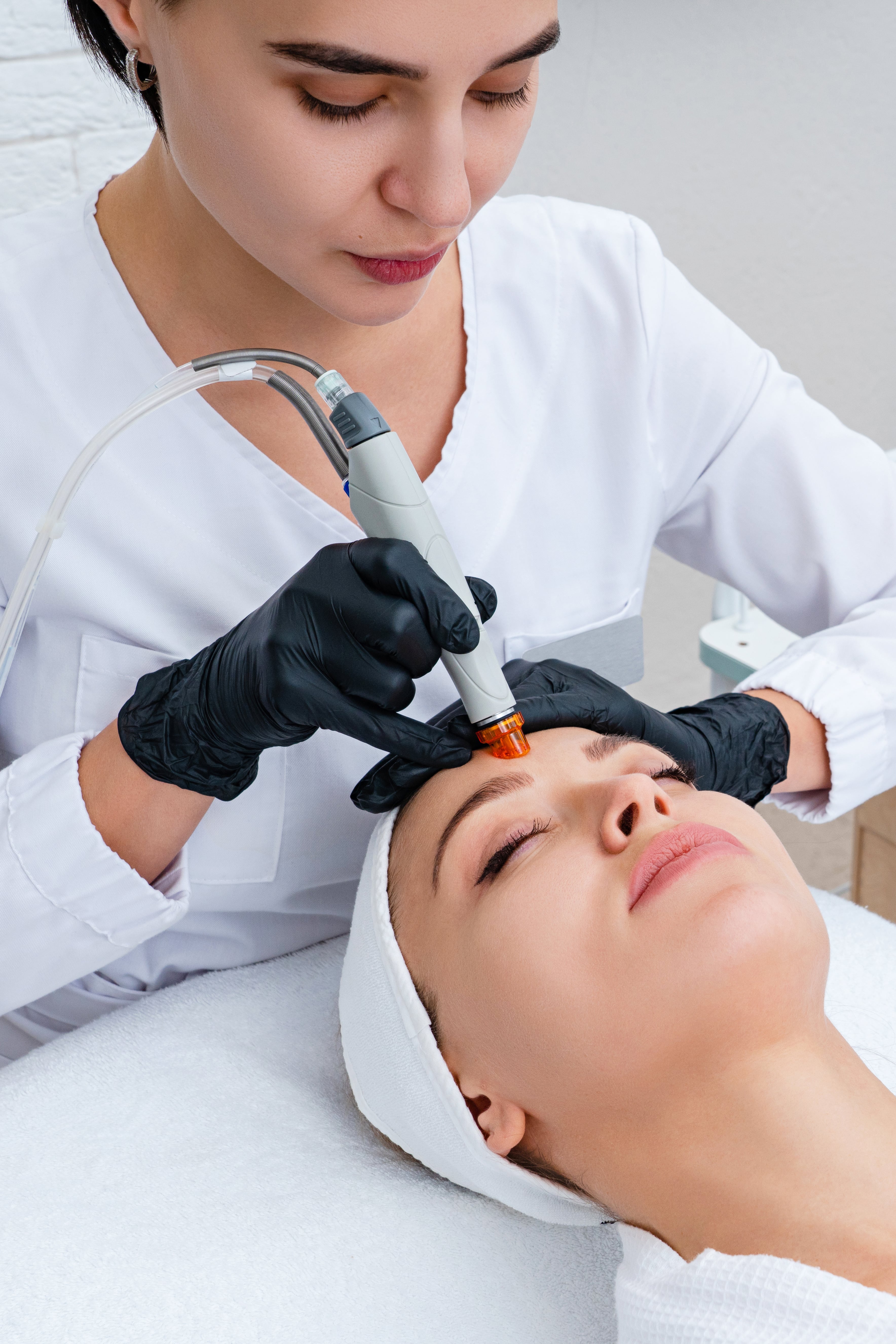 Dermapen Session – Skin Renewal & Collagen Stimulation