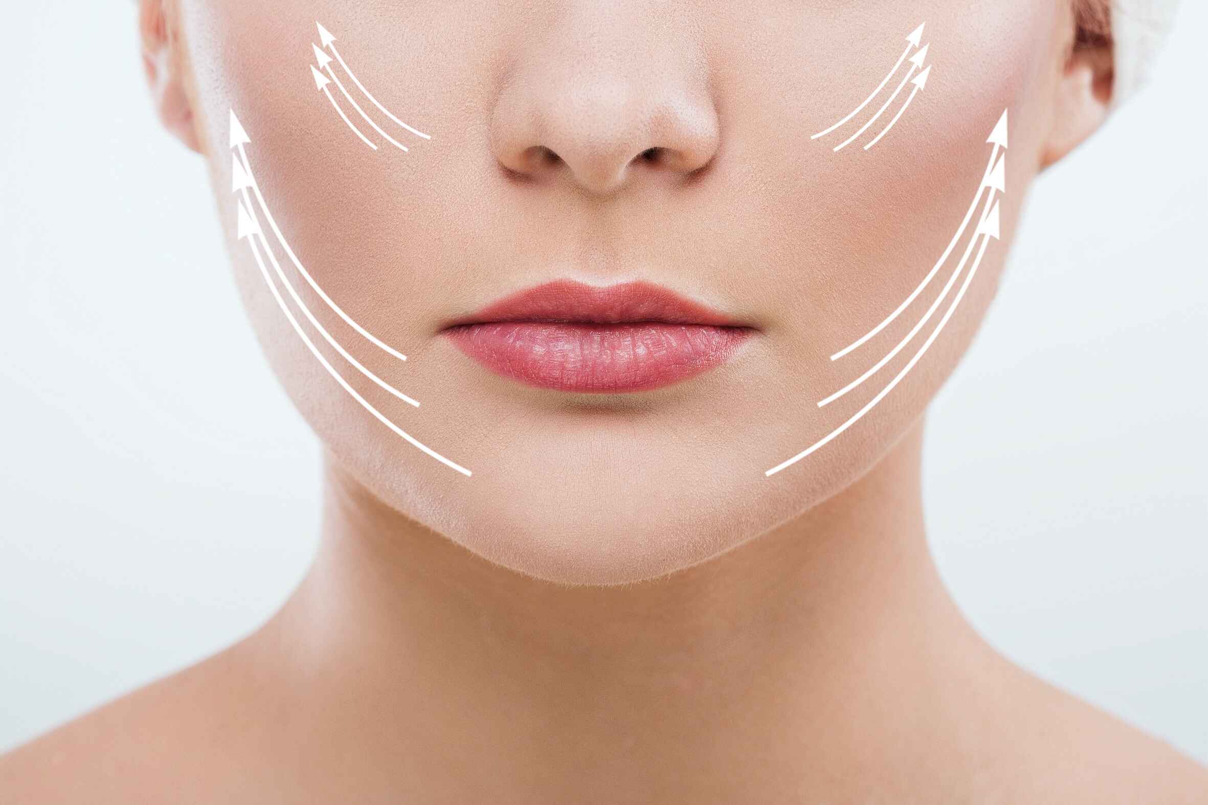 Korean Thread Lift Session – Non-Surgical Face Lifting & Tightening