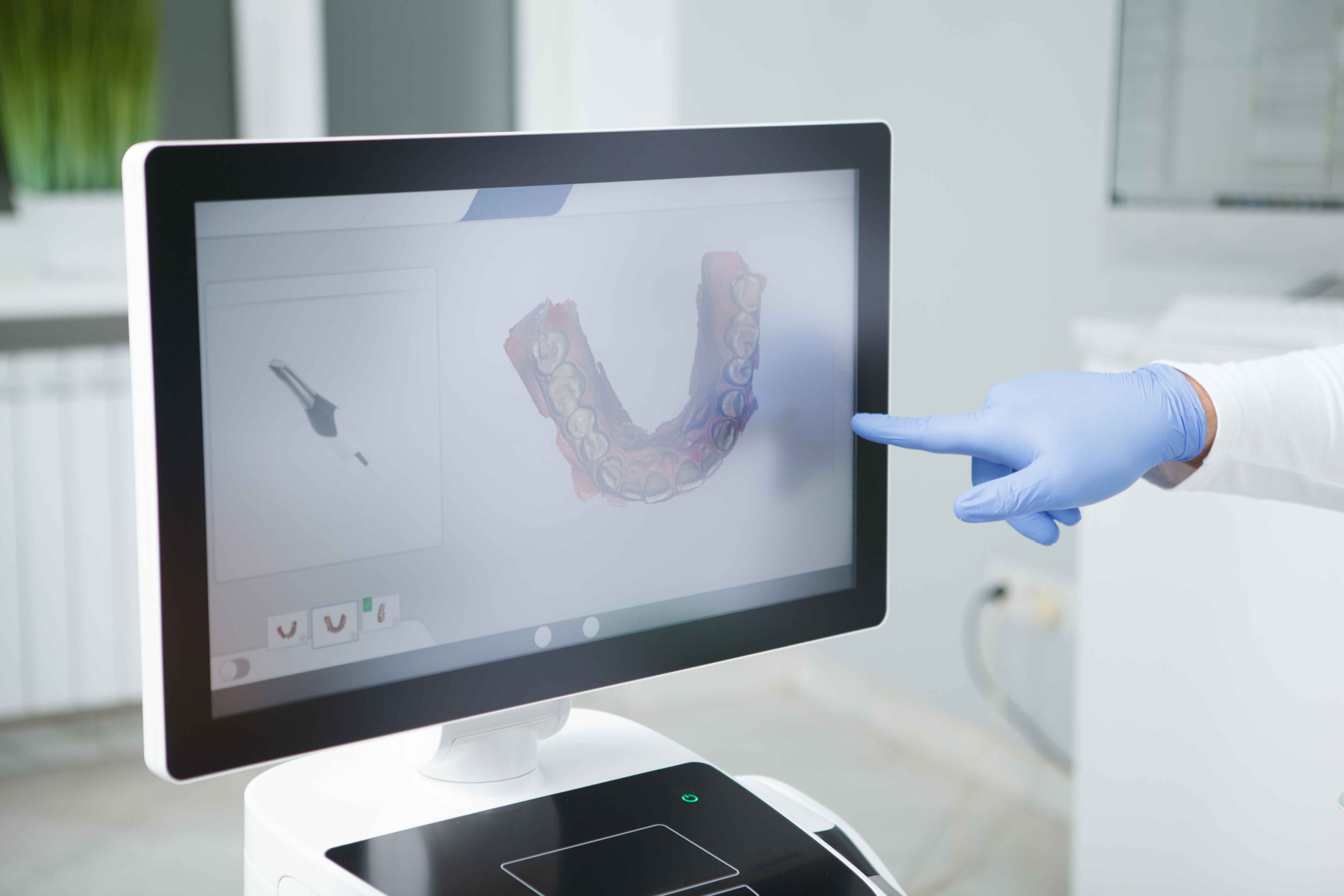 Tooth Extraction for Pain Relief and Decay Treatment