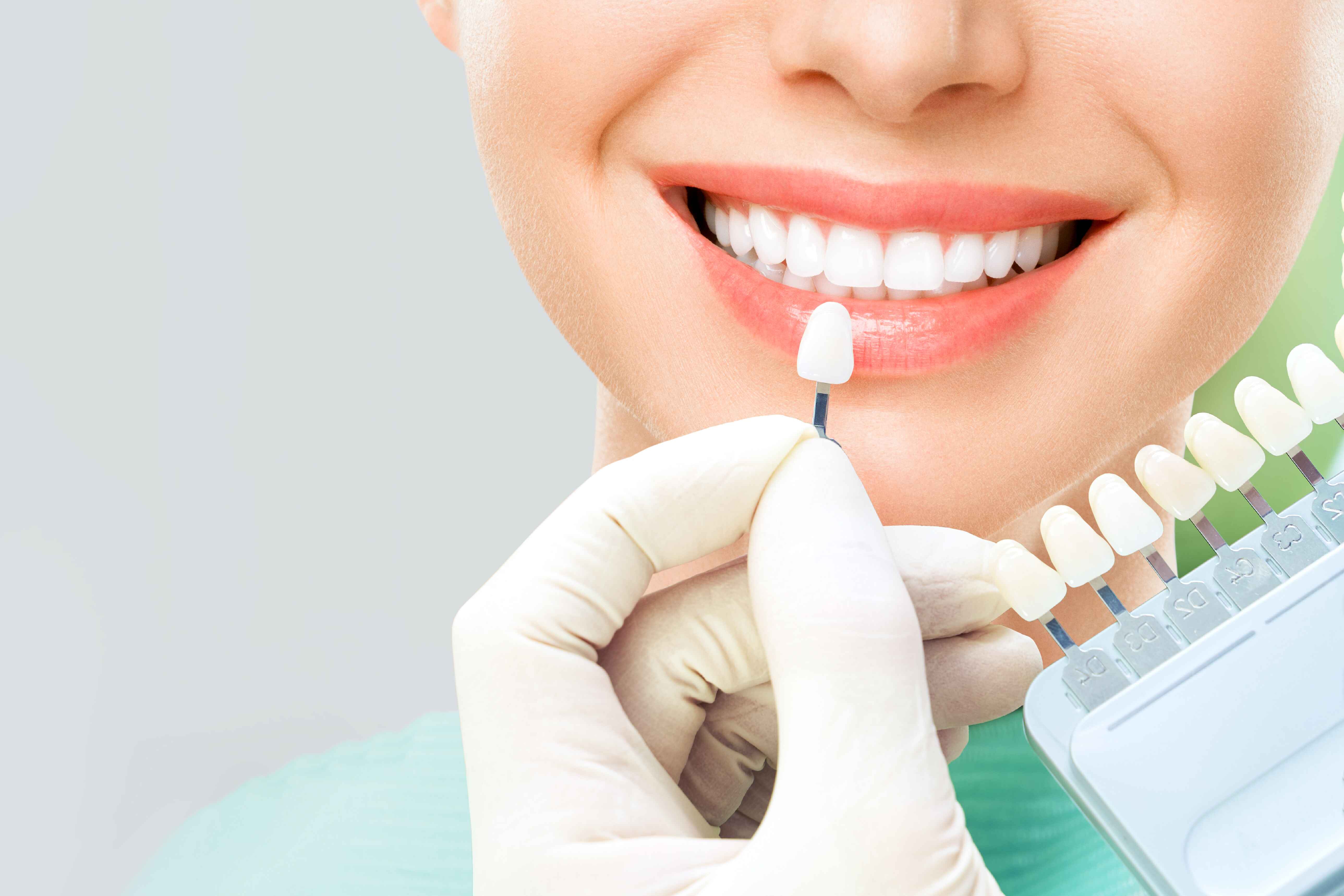 Zirconia Crowns – Strength and Aesthetic Perfection for a Long-Lasting Smile