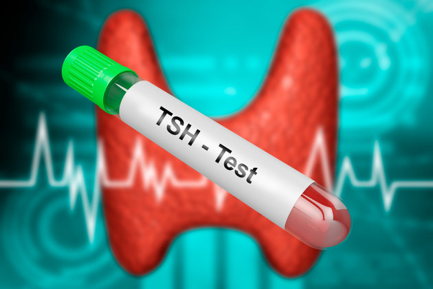 Thyroid stimulating hormone (TSH) test