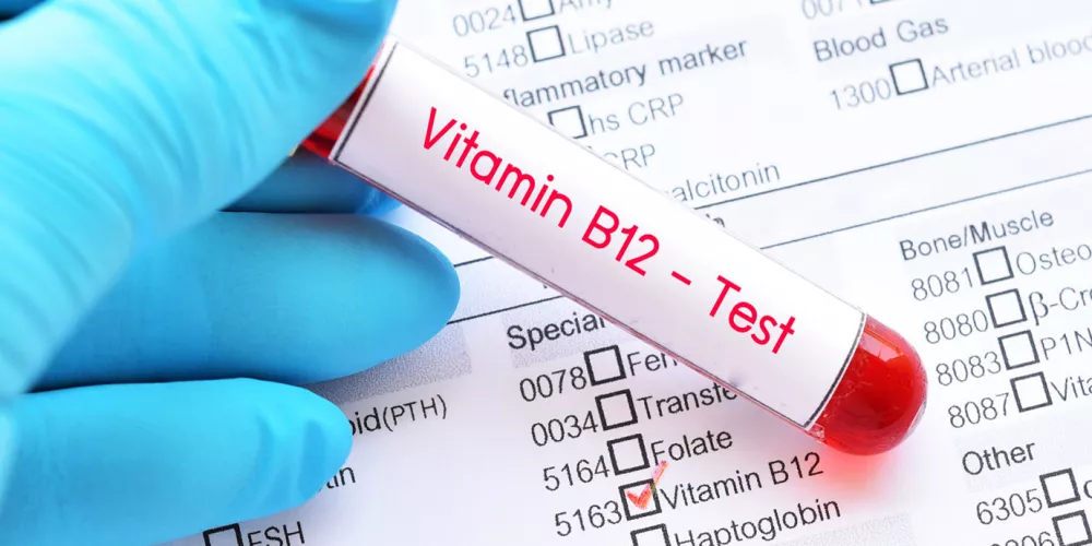 Comprehensive medical examination, 17 tests, Vitamin D, and Vitamin B12 .
