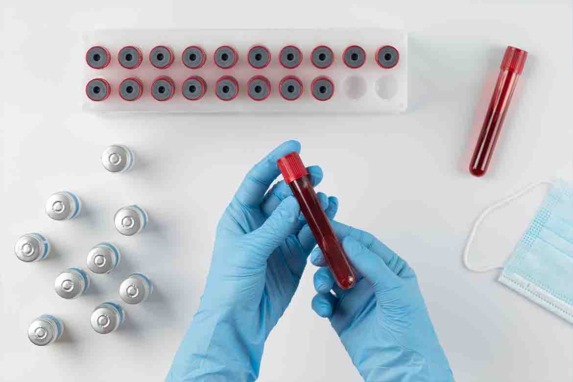 Anemia and general weakness tests