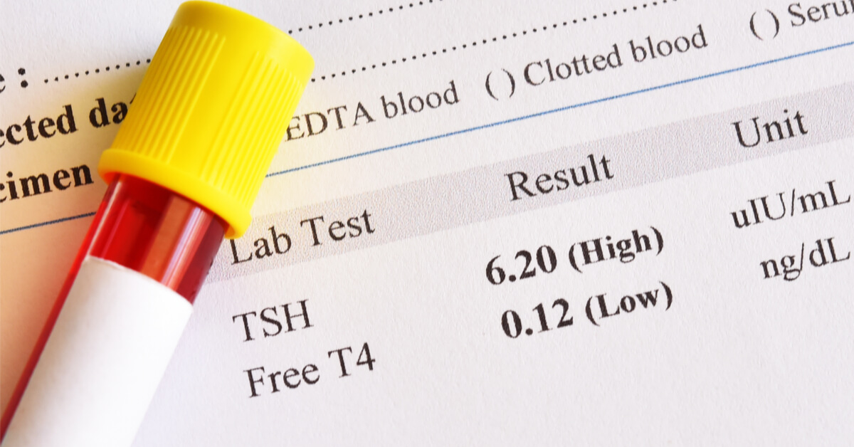 Thyroid and lipid tests