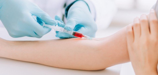 Anemia and general weakness tests