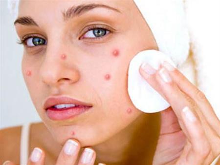 Acne tests