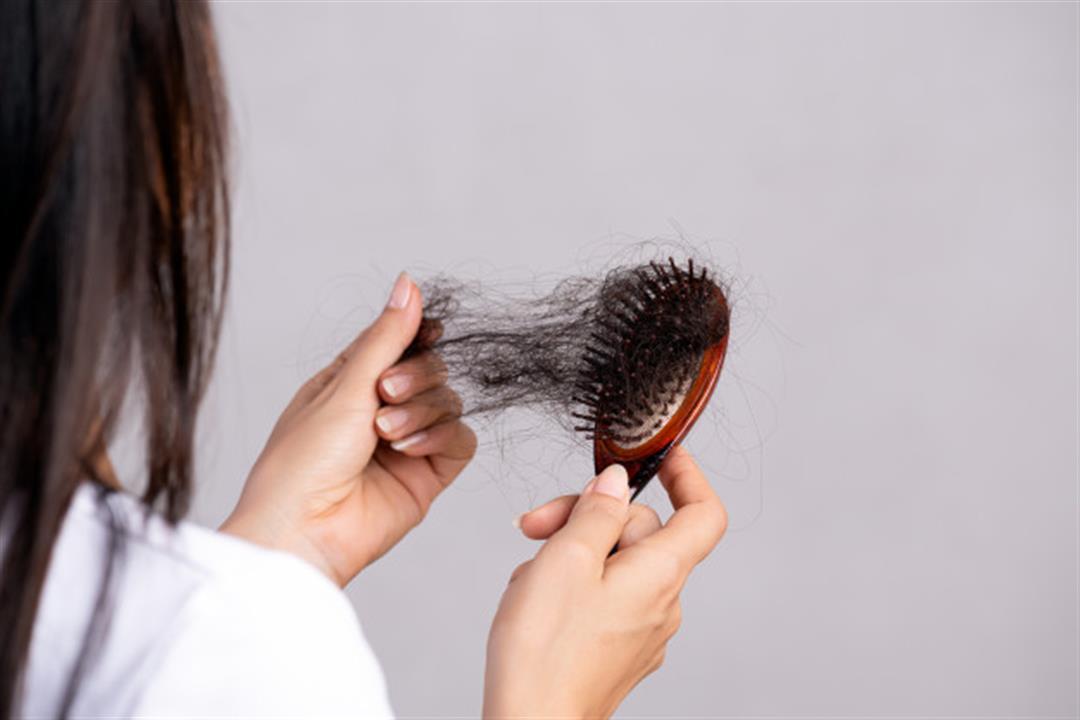 Hair loss tests