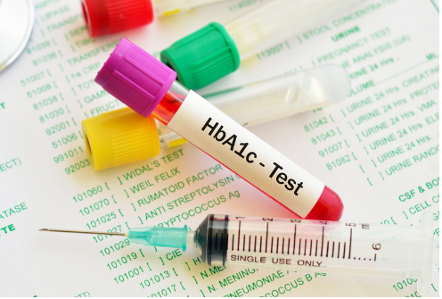 glycated hemoglobin analysis