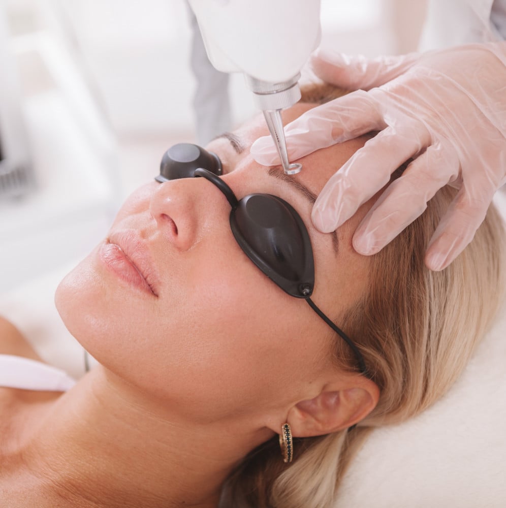 عروض التشقير