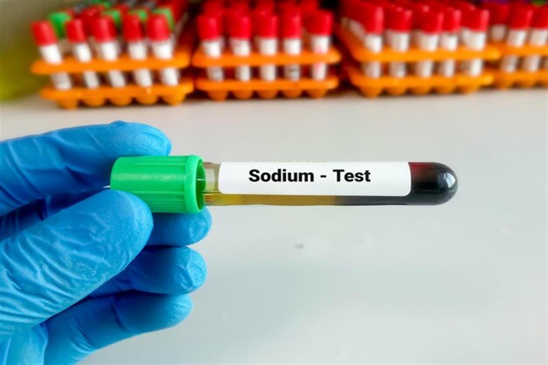 تحليل الصوديوم