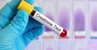 تحليل الكرياتينين