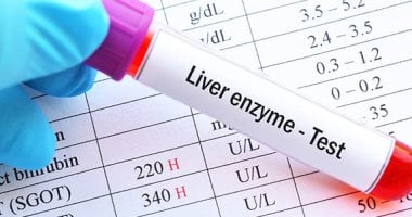 تحليل إنزيم الكبد AST