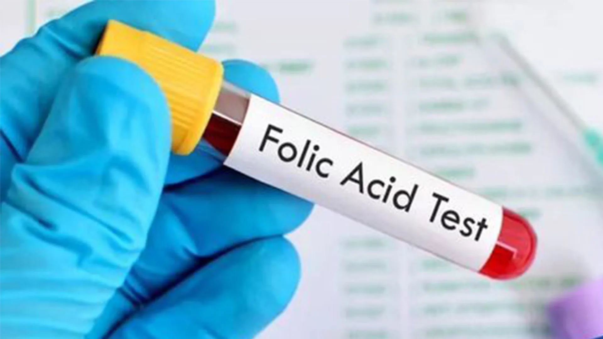 تحليل فيتامين ب9