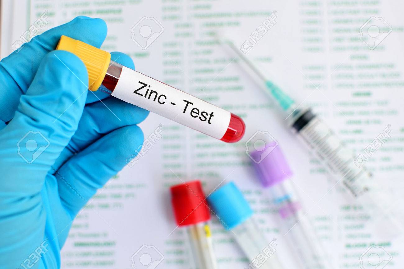 تحليل الزنك