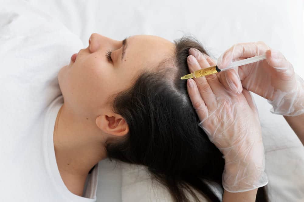 حقن اكسوزوم للشعر -  أحدث تقنية لعلاج تساقط الشعر وتحفيز النمو الطبيعي