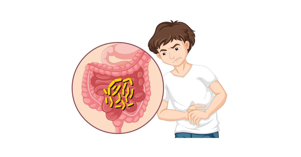 Digestive Disorders