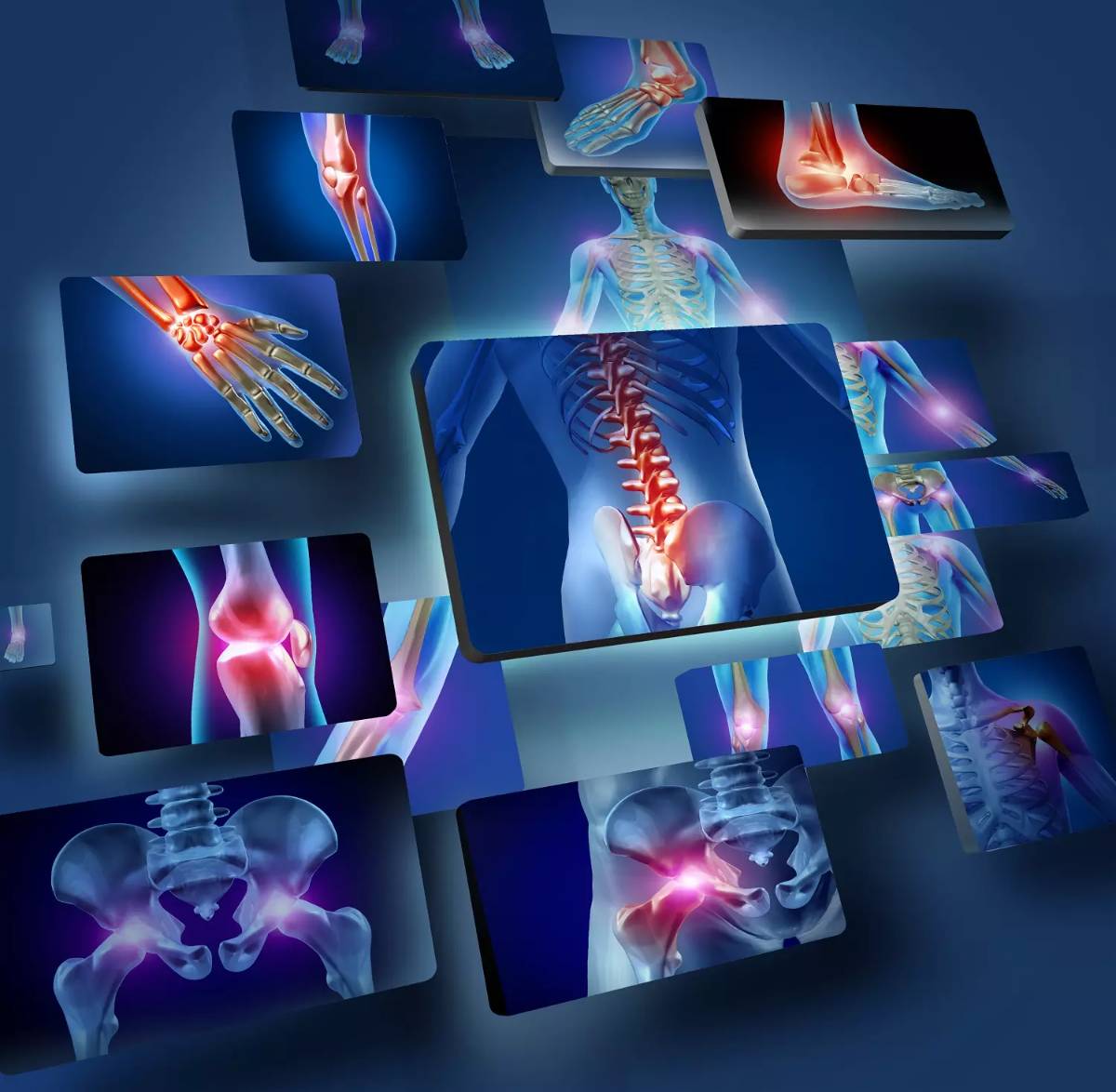 Pain Management