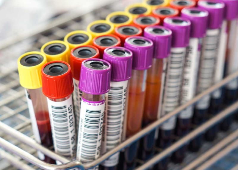 Can Police Make You Give a Blood Sample for a DUI?