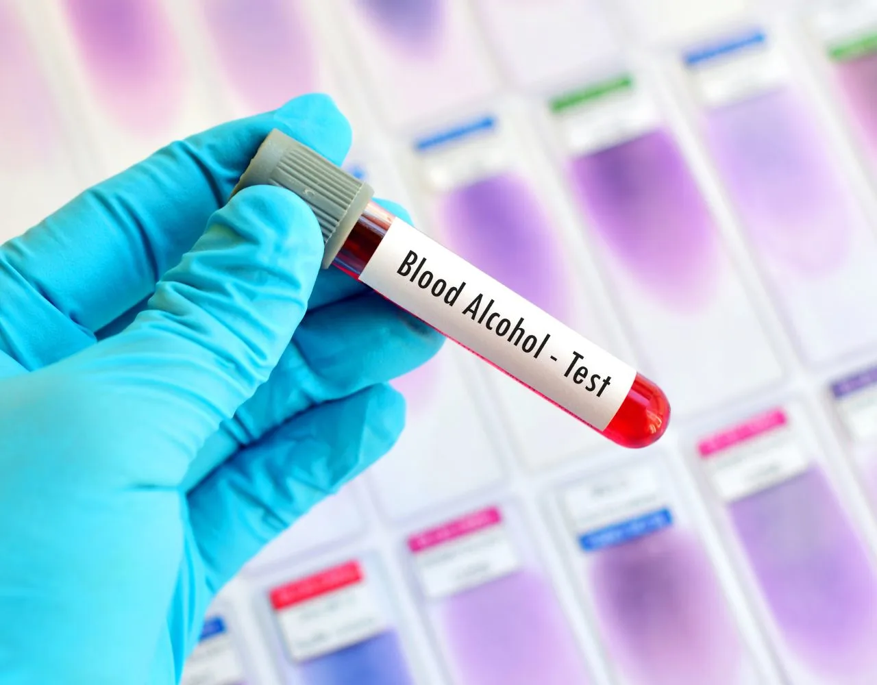 A gloved hand holds a blood sample vial labeled "Blood Alcohol - Test.
